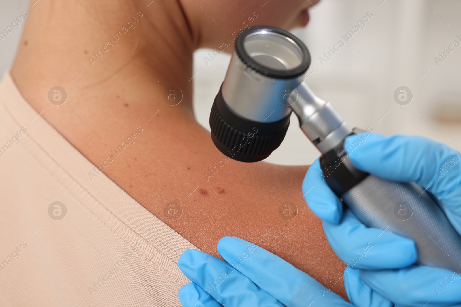 Photo of Doctor examining young woman's mole with dermatoscope in hospital, closeup
