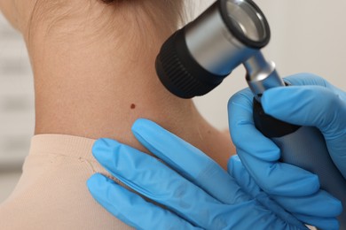 Photo of Doctor examining young woman's mole with dermatoscope in hospital, closeup