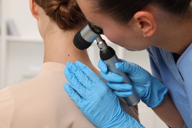 Photo of Doctor examining young woman's mole with dermatoscope in hospital, closeup