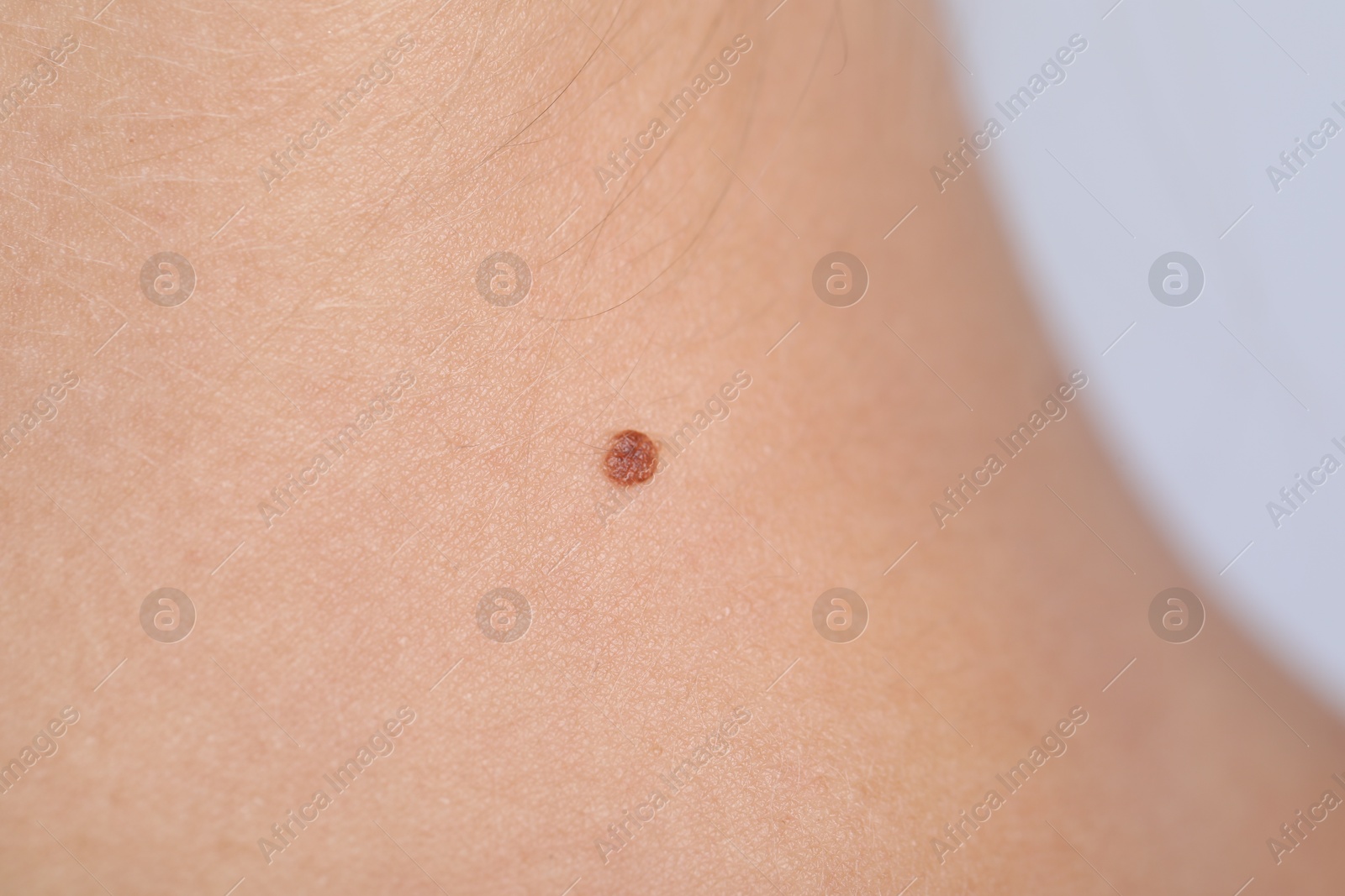 Photo of Woman with mole on her body against light grey background, closeup