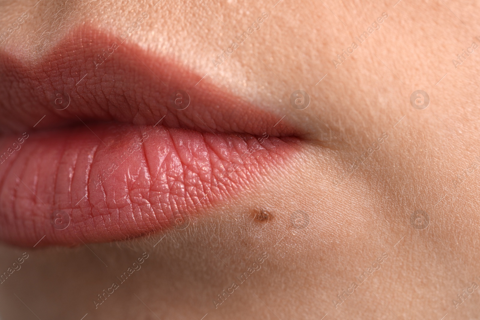 Photo of Woman with mole on her face, closeup
