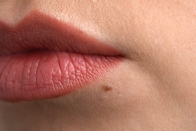 Photo of Woman with mole on her face, closeup