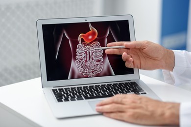 Photo of Gastroenterologist showing screen with illustration of digestive tract in clinic, closeup