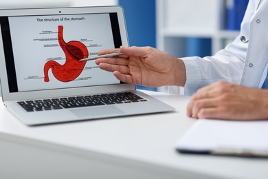 Photo of Gastroenterologist showing screen with illustration of stomach at white table in clinic, closeup