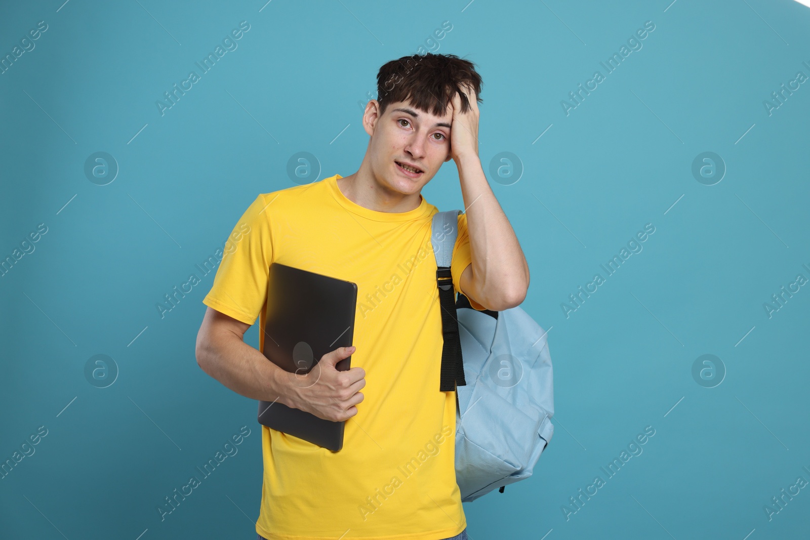 Worried student with laptop on light blue background Photo of Worried student with laptop on light blue background