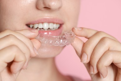 Photo of Smiling woman wearing dental aligner on pink background, closeup