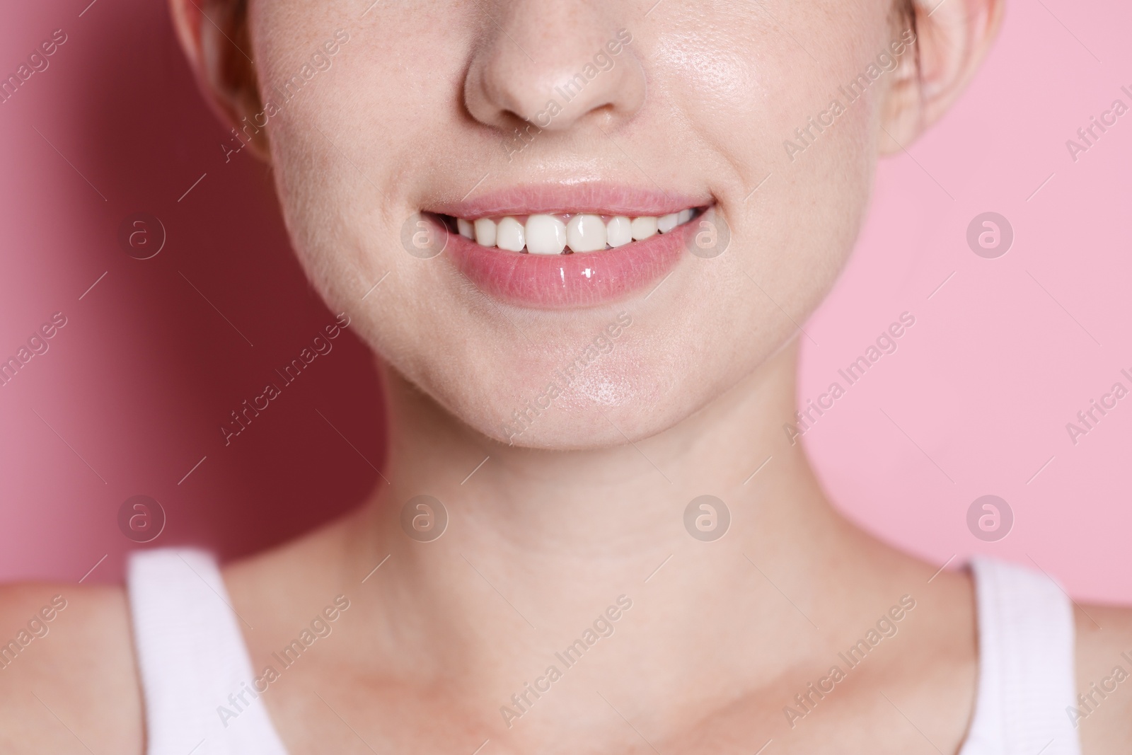 Smiling woman after dental aligners treatment on pink background, closeup Photo of Smiling woman after dental aligners treatment on pink background, closeup