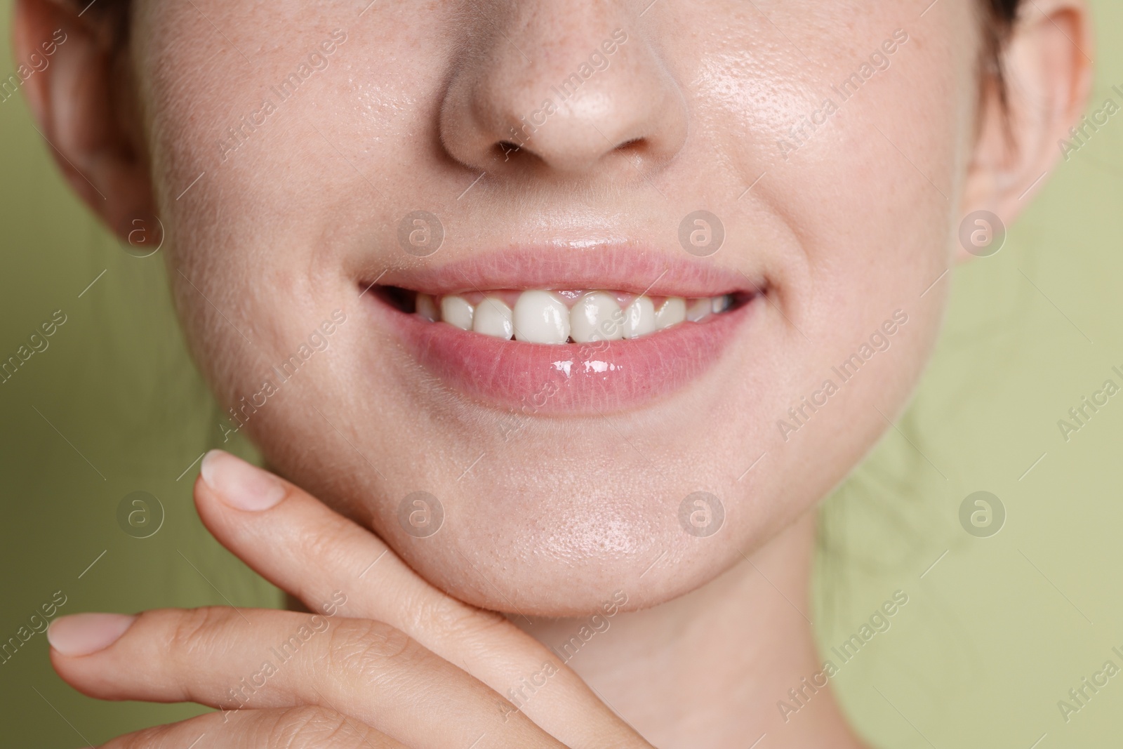 Smiling woman after dental aligners treatment on green background, closeup Photo of Smiling woman after dental aligners treatment on green background, closeup