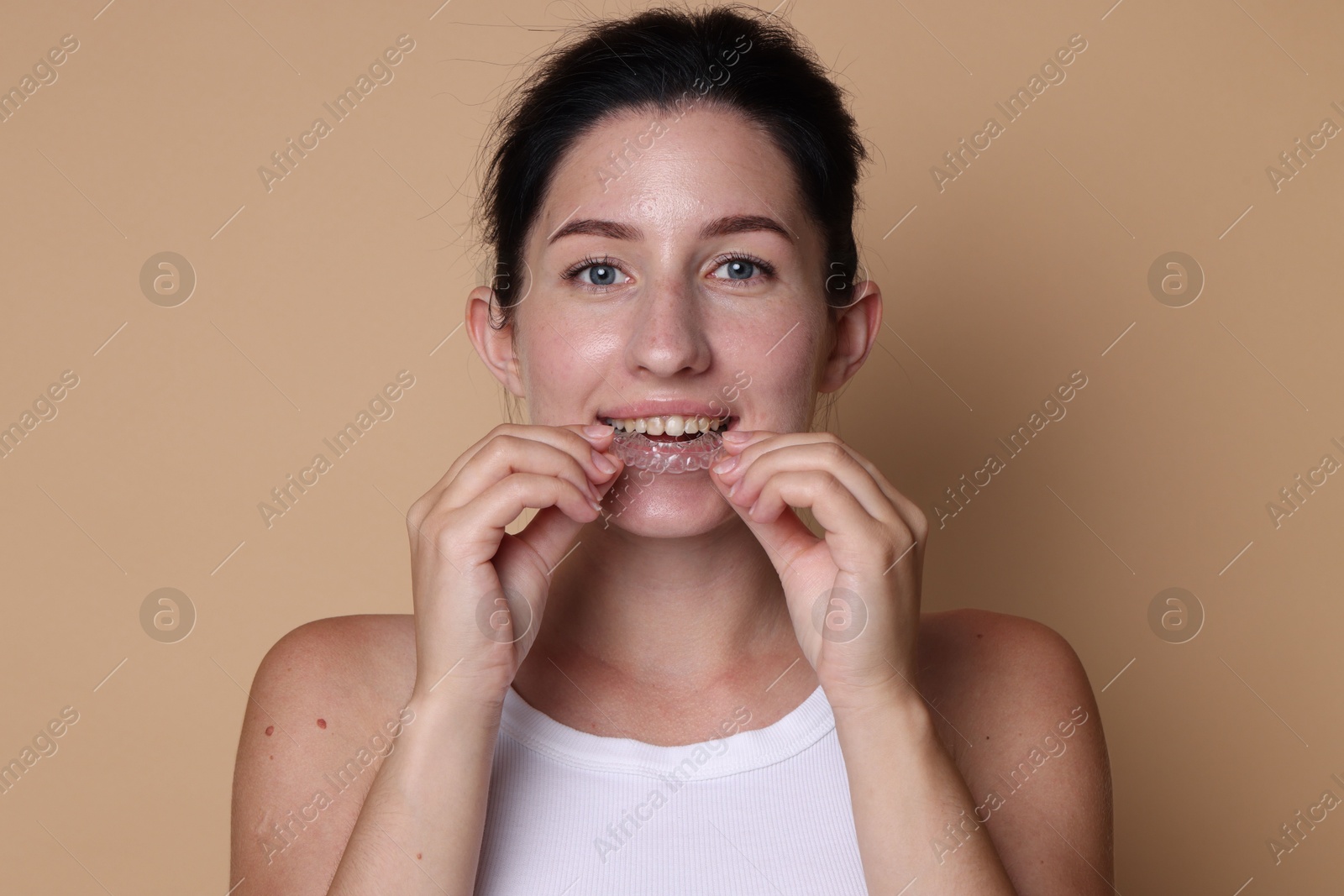 Young woman wearing dental aligner on beige background Photo of Young woman wearing dental aligner on beige background