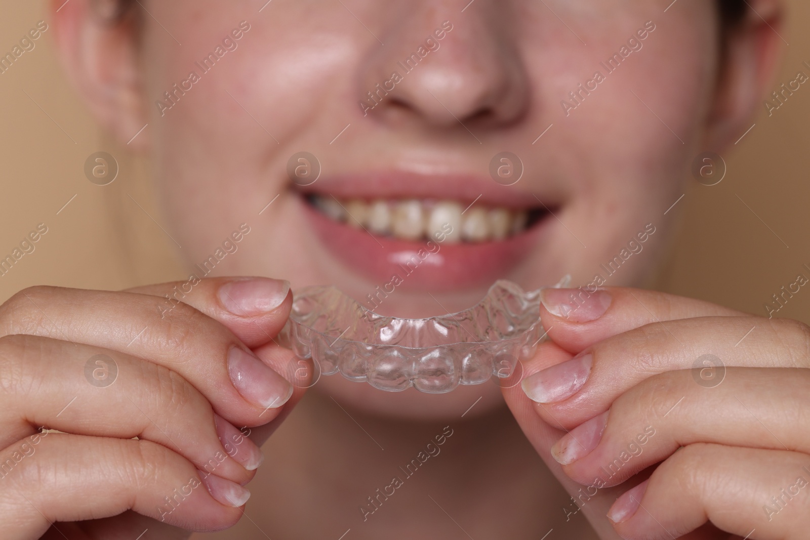 Smiling woman wearing dental aligner on beige background, selective focus Photo of Smiling woman wearing dental aligner on beige background, selective focus