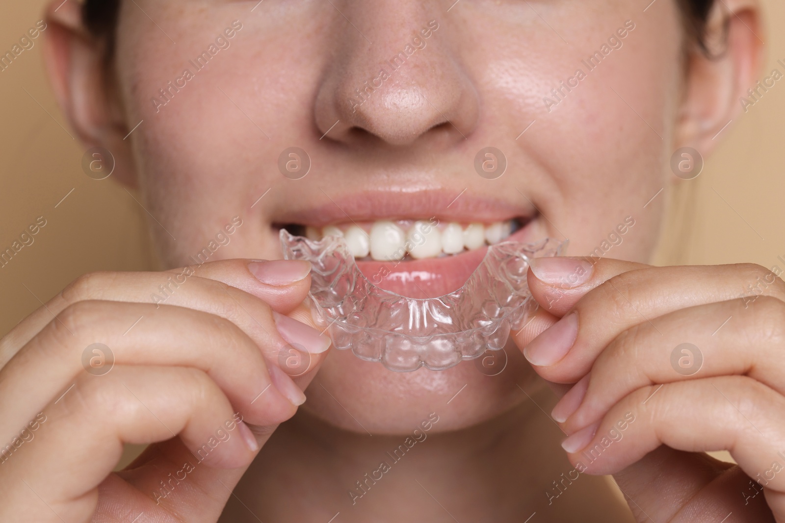 Smiling woman wearing dental aligner on beige background, closeup Photo of Smiling woman wearing dental aligner on beige background, closeup