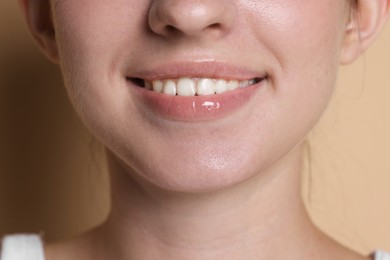 Photo of Smiling woman after dental aligners treatment on beige background, closeup