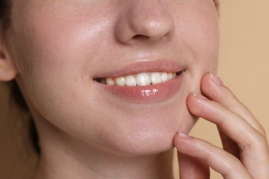 Photo of Smiling woman after dental aligners treatment on beige background, closeup