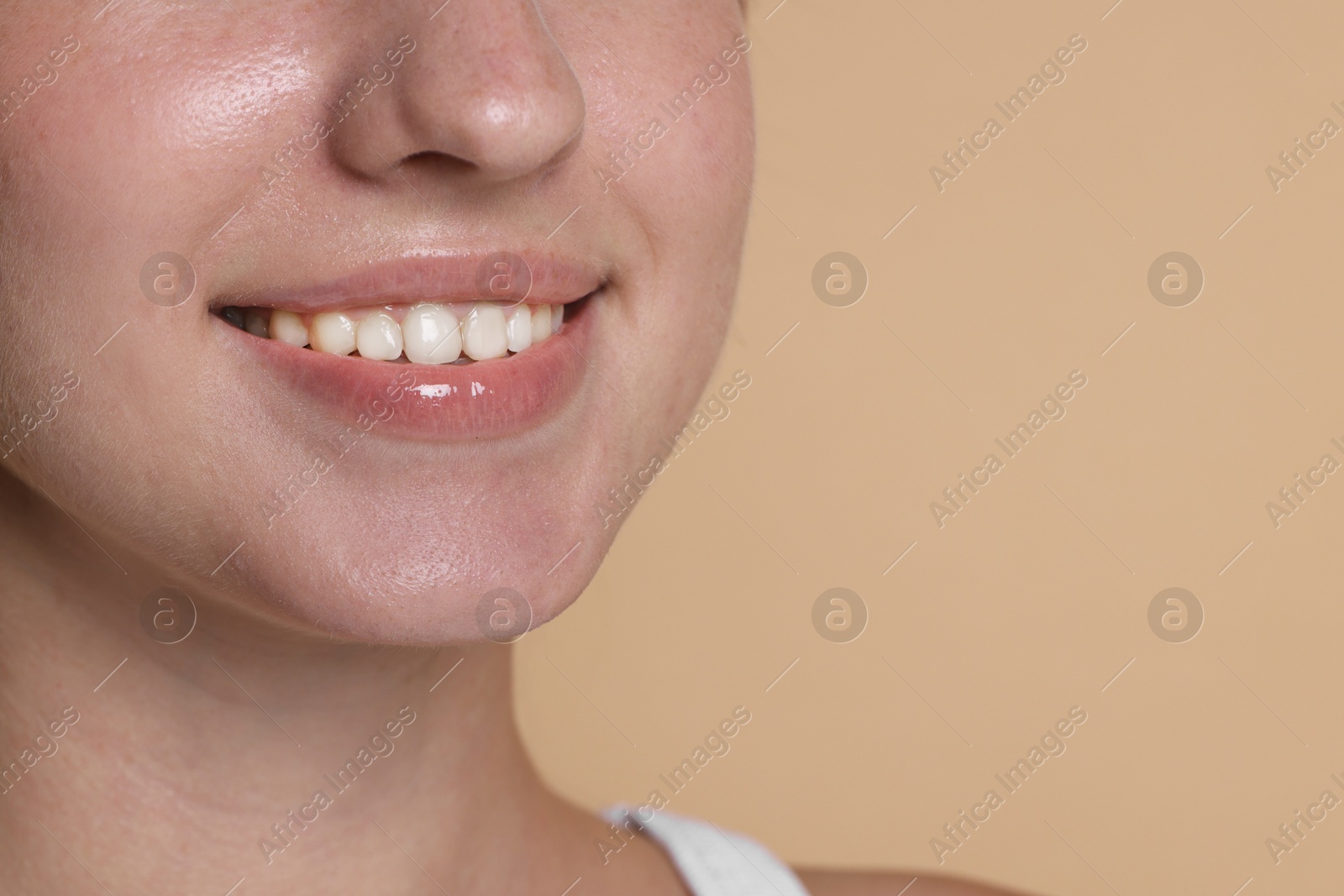 Smiling woman after dental aligners treatment on beige background, closeup. Space for text Photo of Smiling woman after dental aligners treatment on beige background, closeup. Space for text