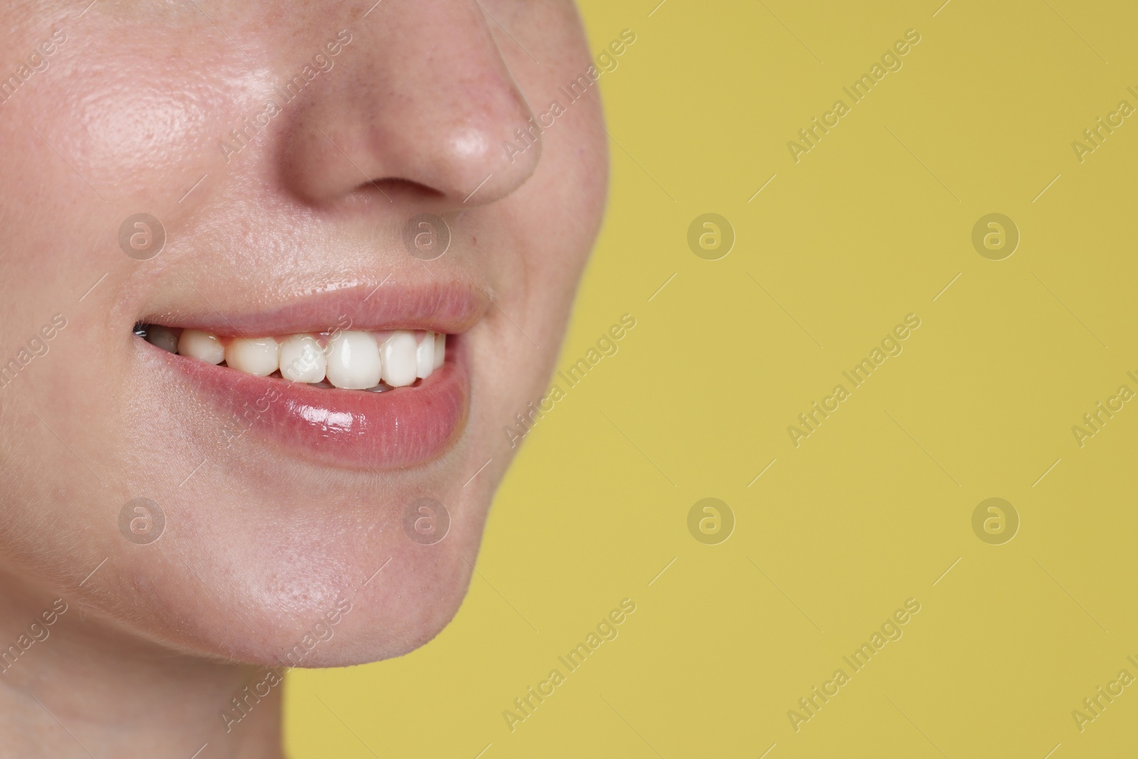 Smiling woman after dental aligners treatment on yellow background, closeup. Space for text Photo of Smiling woman after dental aligners treatment on yellow background, closeup. Space for text