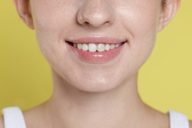 Photo of Smiling woman after dental aligners treatment on yellow background, closeup
