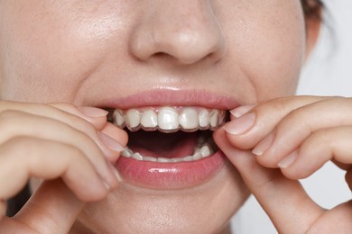 Photo of Woman wearing dental aligner on grey background, closeup