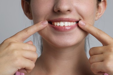 Photo of Smiling woman after dental aligners treatment on grey background, closeup