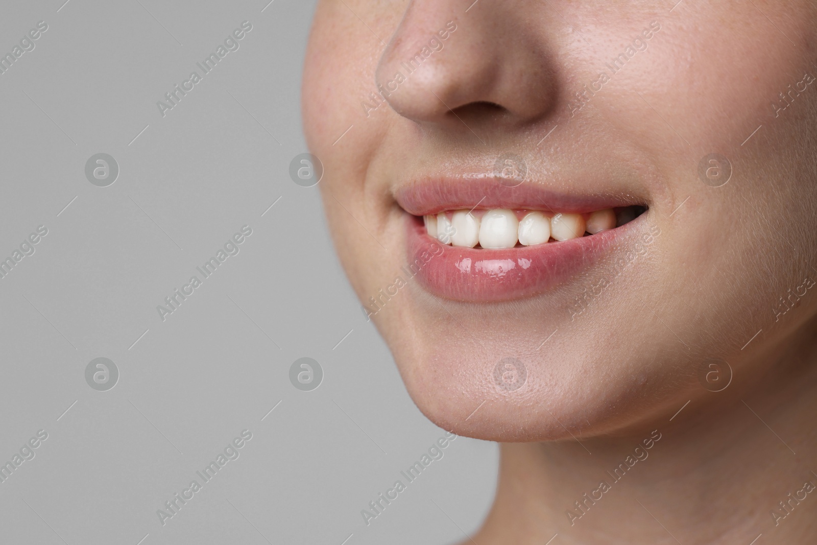 Smiling woman after dental aligners treatment on grey background, closeup. Space for text Photo of Smiling woman after dental aligners treatment on grey background, closeup. Space for text