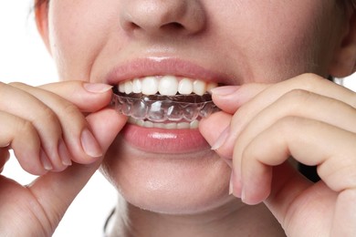 Photo of Woman wearing dental aligner on white background, closeup