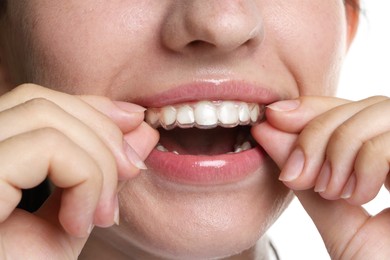 Photo of Woman wearing dental aligner on white background, closeup