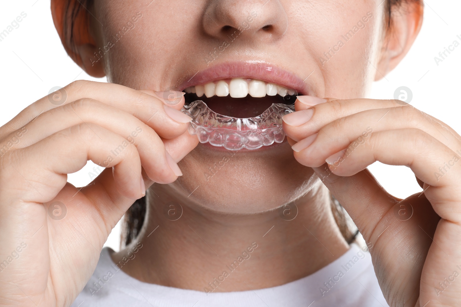 Woman wearing dental aligner on white background, closeup Photo of Woman wearing dental aligner on white background, closeup