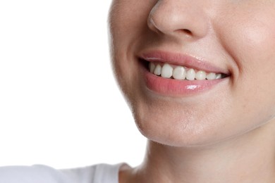 Photo of Smiling woman after dental aligners treatment on white background, closeup