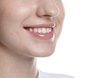 Photo of Smiling woman after dental aligners treatment on white background, closeup