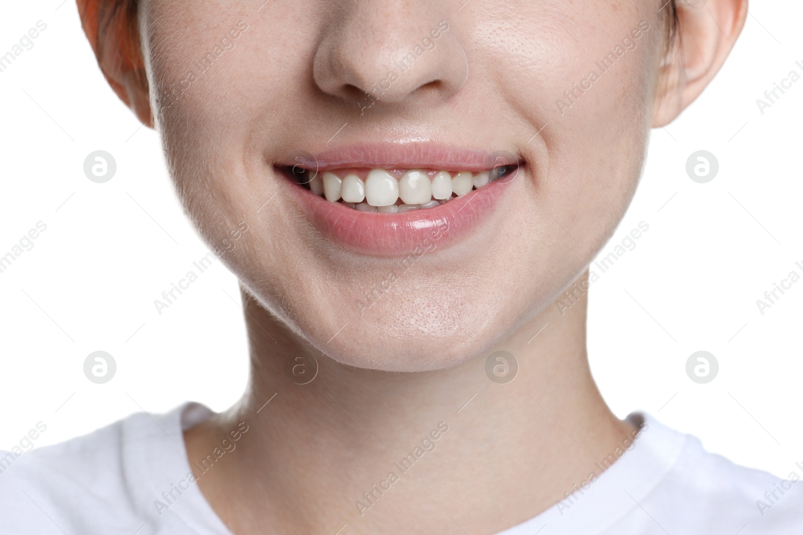 Smiling woman after dental aligners treatment on white background, closeup Photo of Smiling woman after dental aligners treatment on white background, closeup