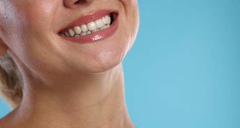 Photo of Woman with beautiful healthy teeth on light blue background, closeup. Space for text