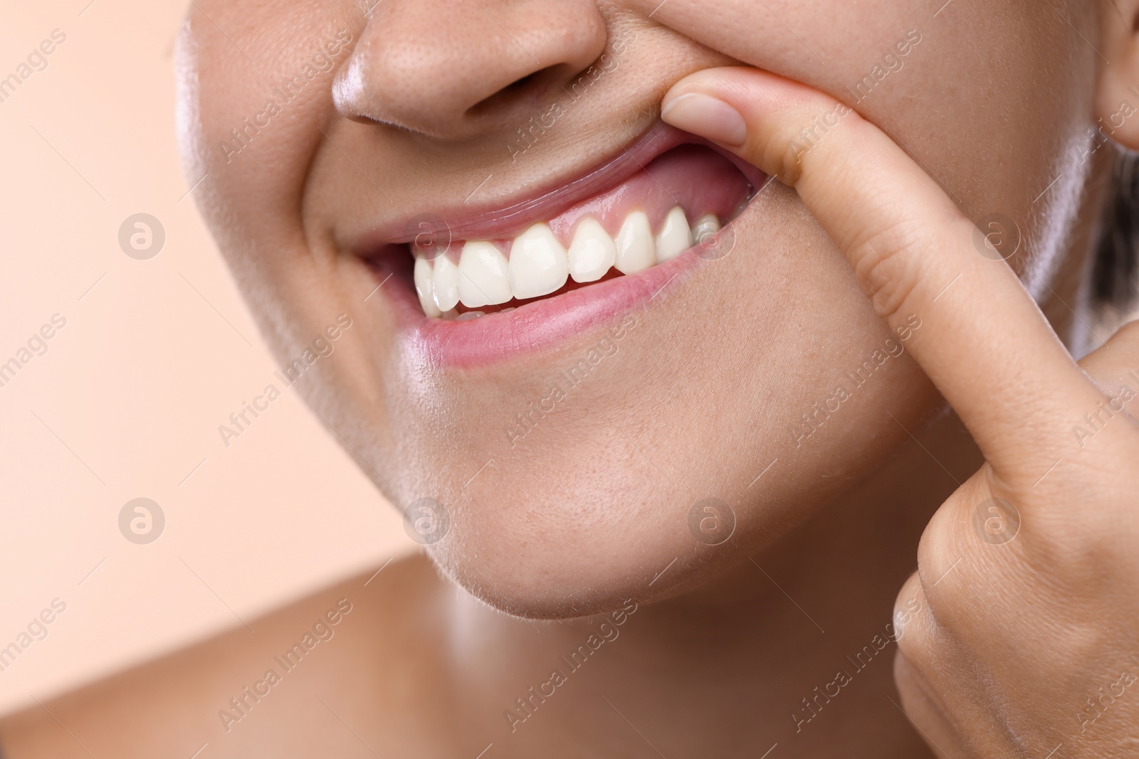 Photo of Woman showing her teeth and gums on beige background, closeup