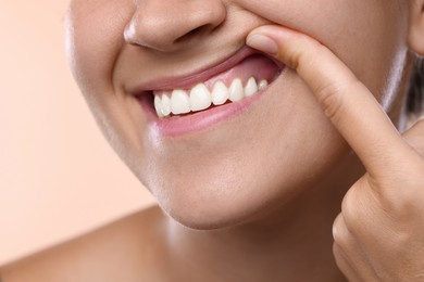 Photo of Woman showing her teeth and gums on beige background, closeup
