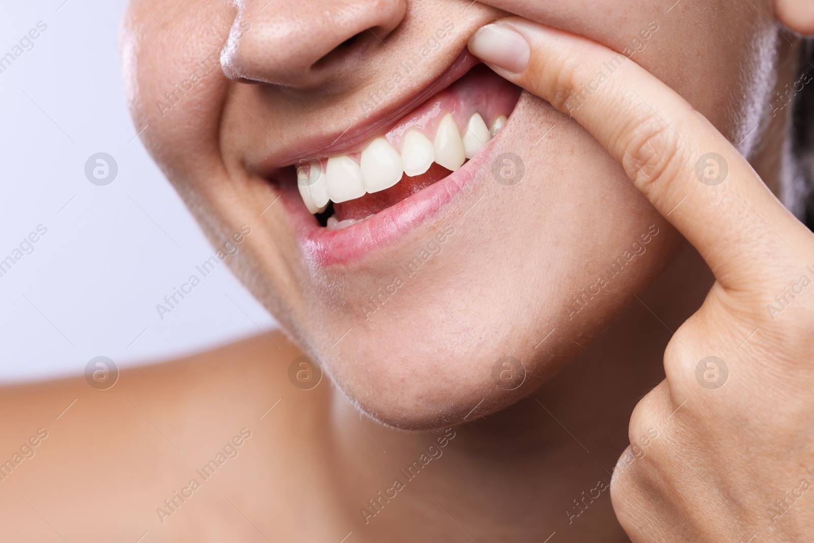 Photo of Woman showing her teeth and gums on light background, closeup