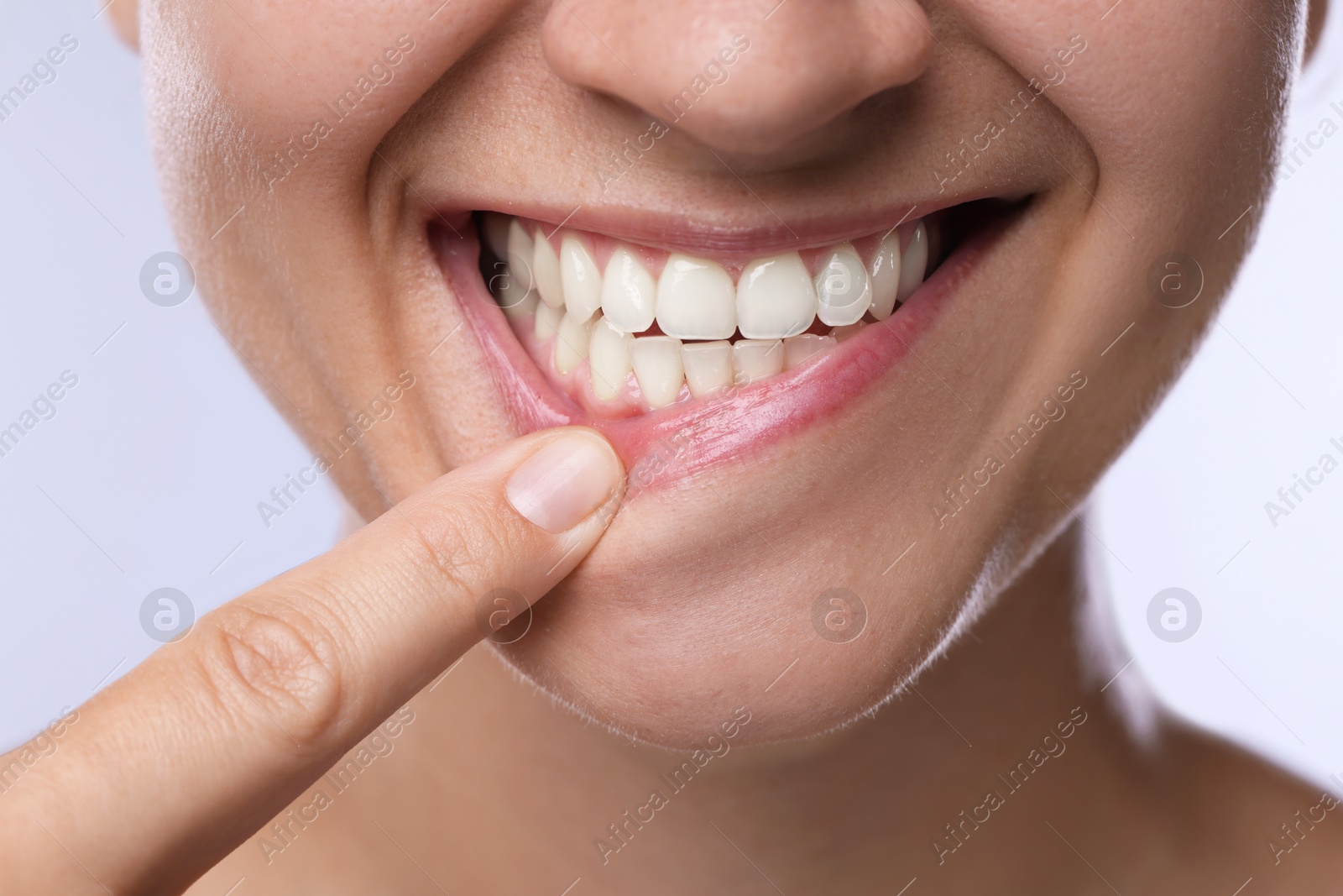 Photo of Woman showing her teeth and gums on light background, closeup