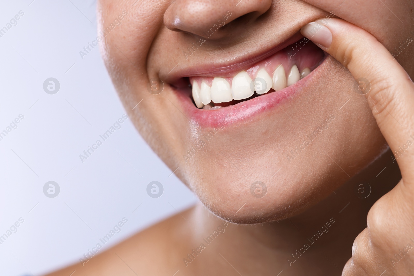 Photo of Woman showing her teeth and gums on light background, closeup
