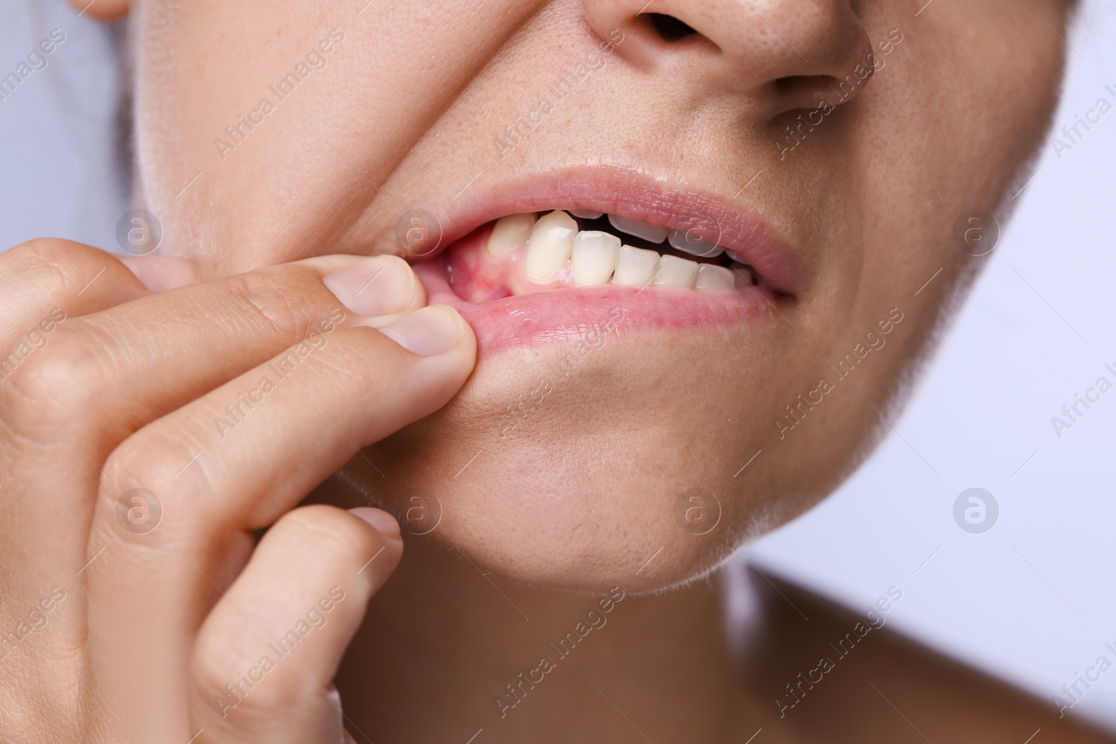 Woman showing her teeth and gums on light background, closeup Photo of Woman showing her teeth and gums on light background, closeup