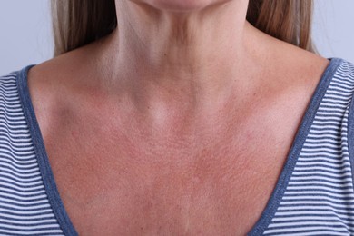 Photo of Woman with healthy skin on light background, closeup