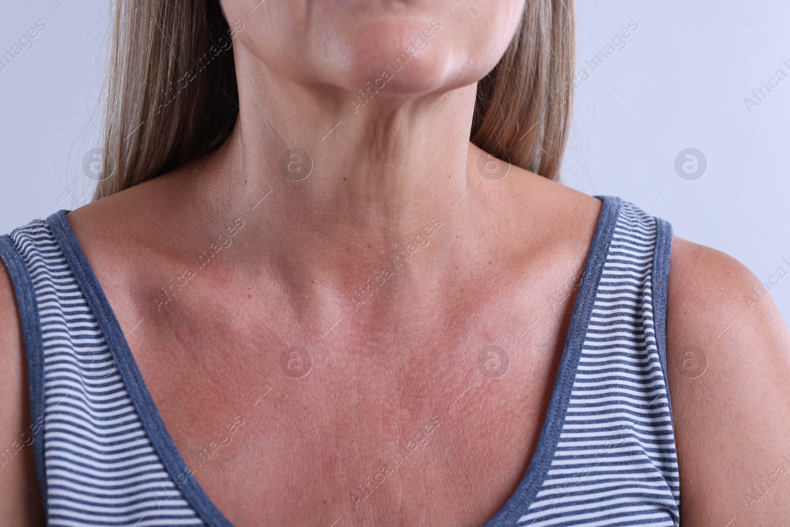 Woman with healthy skin on light background, closeup Photo of Woman with healthy skin on light background, closeup