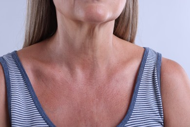 Photo of Woman with healthy skin on light background, closeup