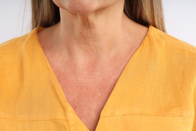 Photo of Woman with healthy skin on light background, closeup