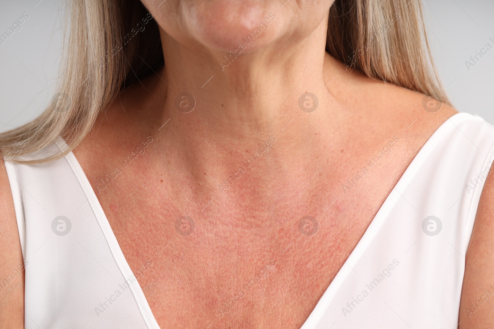 Woman with healthy skin on light background, closeup Photo of Woman with healthy skin on light background, closeup
