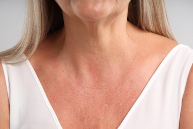 Photo of Woman with healthy skin on light background, closeup