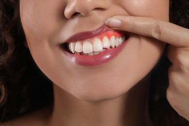 Image of Woman showing inflamed gum, closeup. Oral health