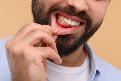 Image of Man showing inflamed gum on beige background, closeup