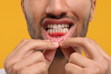 Image of Man showing inflamed gum on orange background, closeup