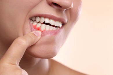Image of Woman showing inflamed gum on beige background, closeup. Space for text