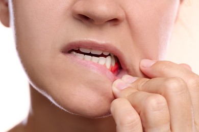 Image of Woman showing inflamed gum on white background, closeup