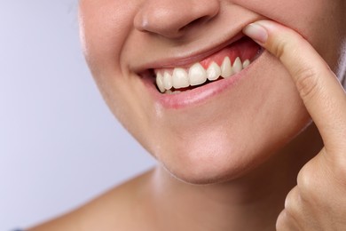 Image of Woman showing inflamed gum on light background, closeup