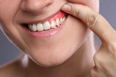 Image of Woman showing inflamed gum on grey background, closeup