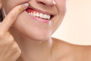 Image of Woman showing inflamed gum on beige background, closeup